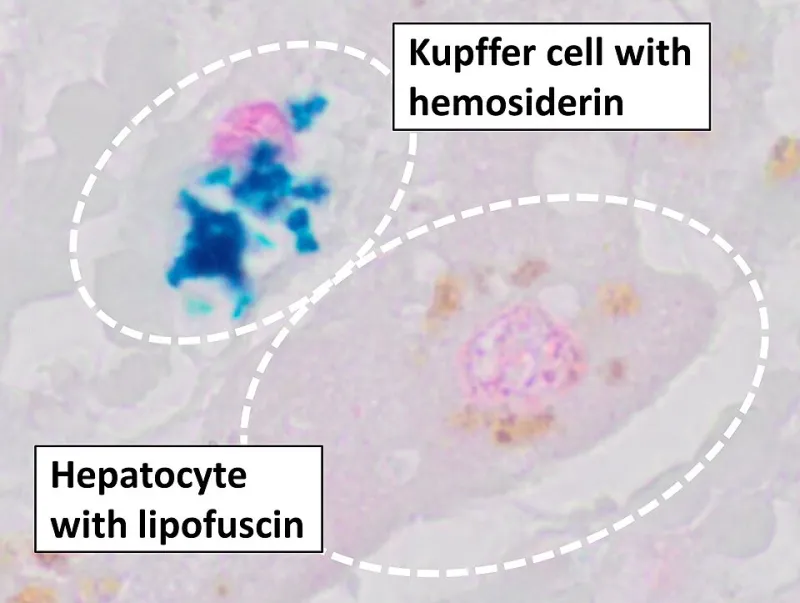 After the Transformation: How Steroid Metabolites Rewrite the Pharmacological Story